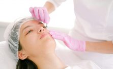 Fillers för läppar: En guide till fylligare läppar